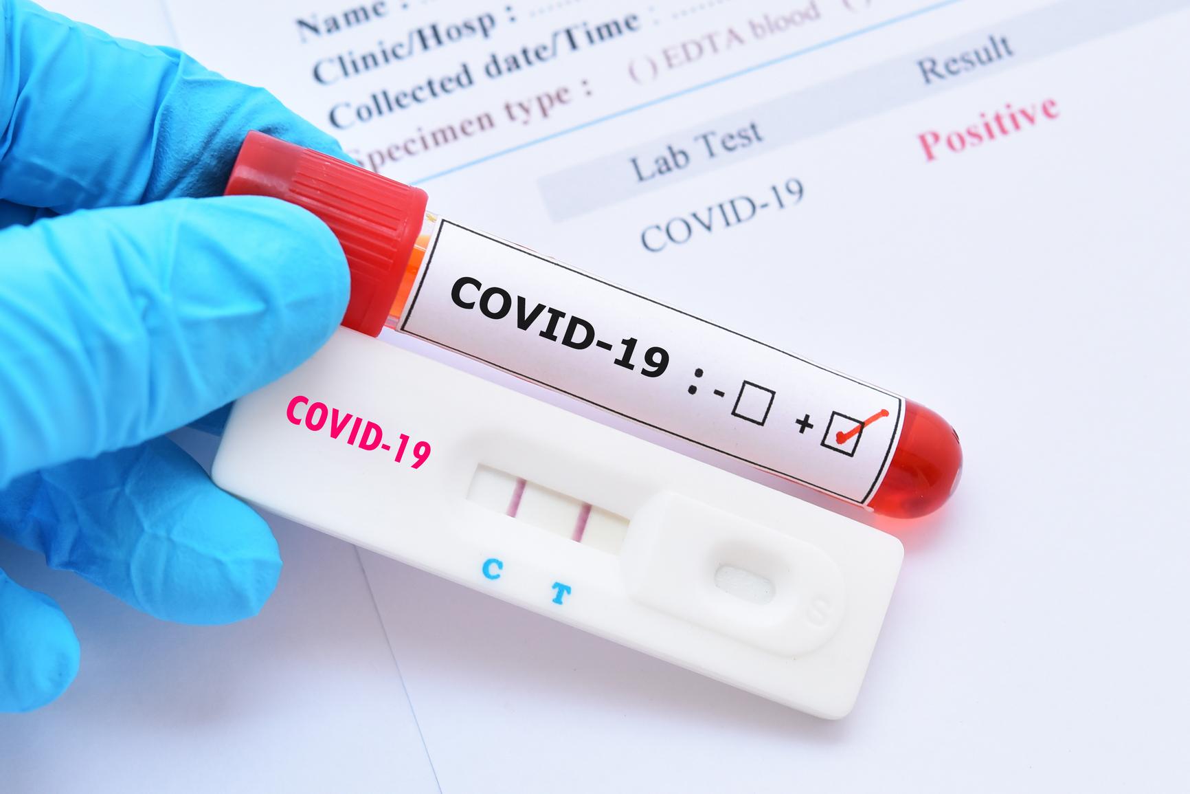 Swabs, Antibodies, Wait Times, and More: What is the COVID-19 test actually  like? - IMPACCT Brooklyn